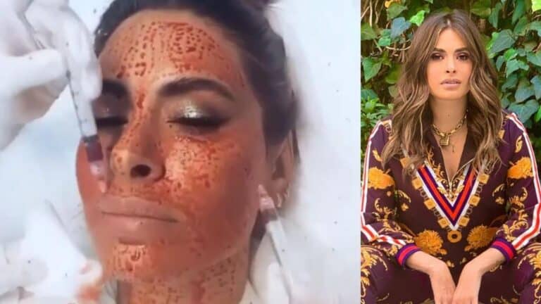 Fans de Galilea Montijo se preocupan por el rostro de la conductora