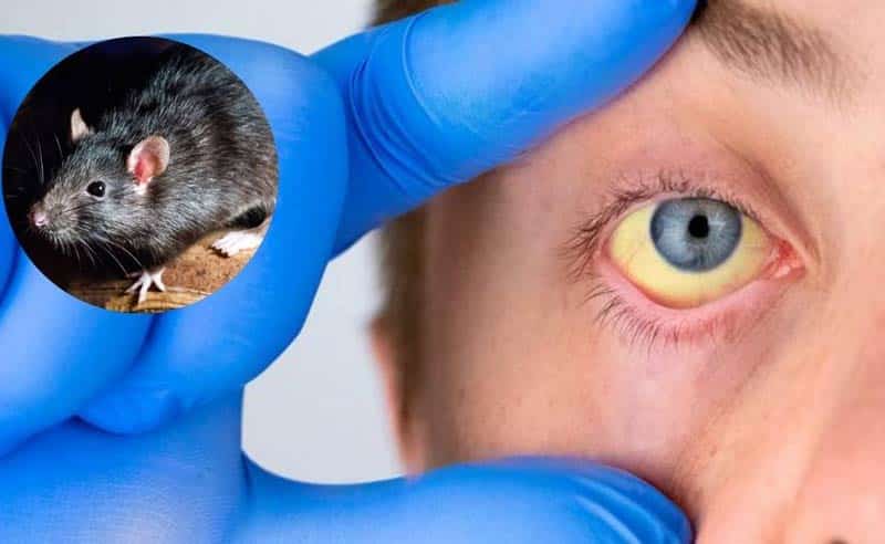 Leptospirosis cobra 19 vidas y supera los 270 casos confirmados en República Dominicana